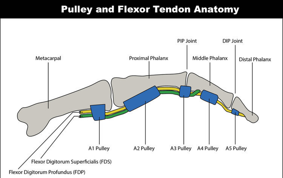  Pulley and flexor tendon anatomy. 