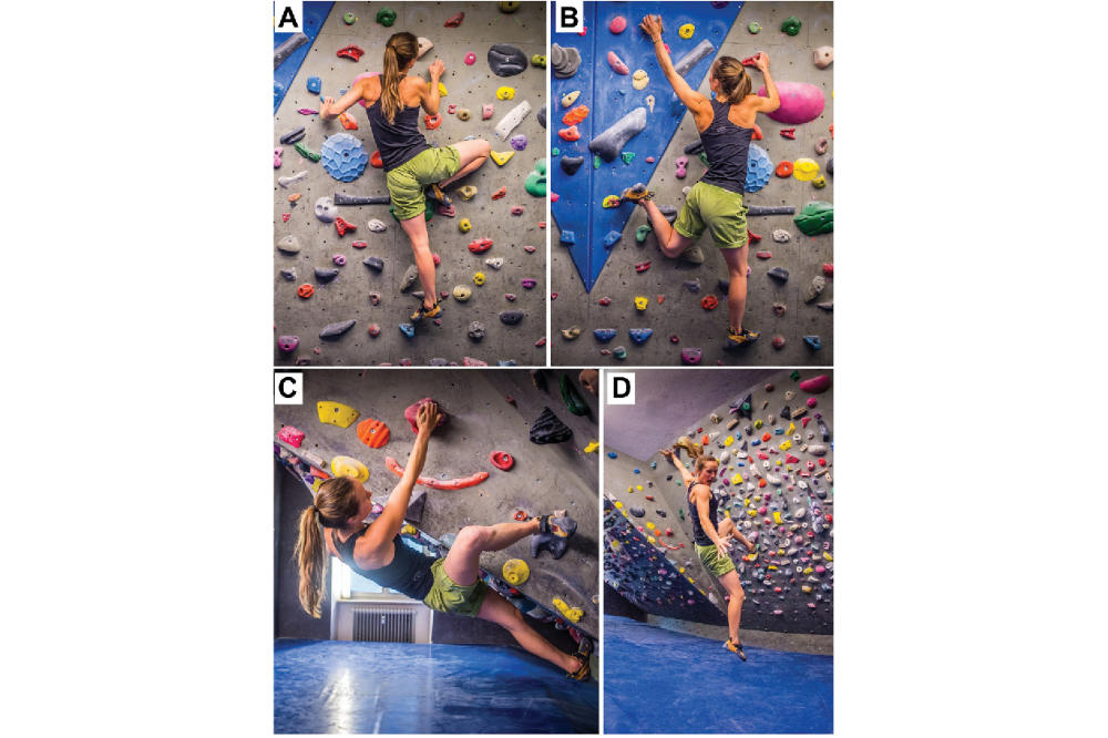 Dealing With Climbing’s Most Common Injuries – Part 3 